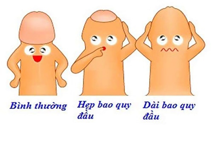 Dấu hiệu nhận biết
