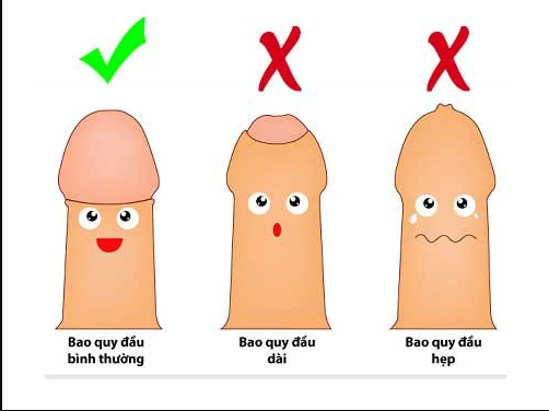 Có nên cắt bao quy đầu không 