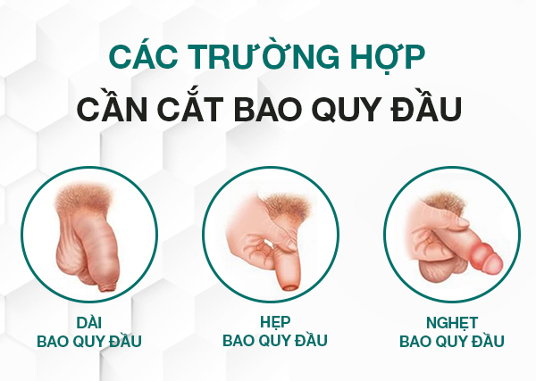Các trường hợp nên cần tiến hành cắt bao quy đầu