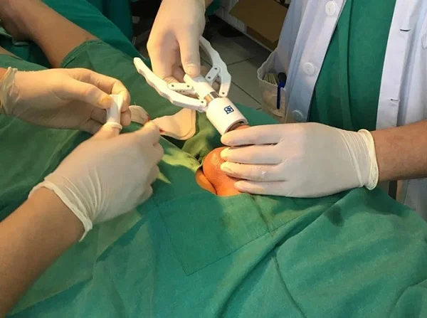 Chăm sóc hậu cắt bao quy đầu