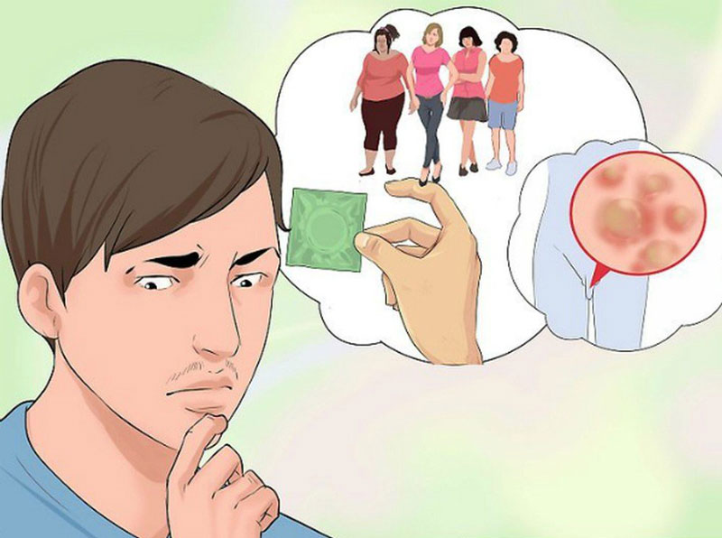 Bệnh Sùi mào gà