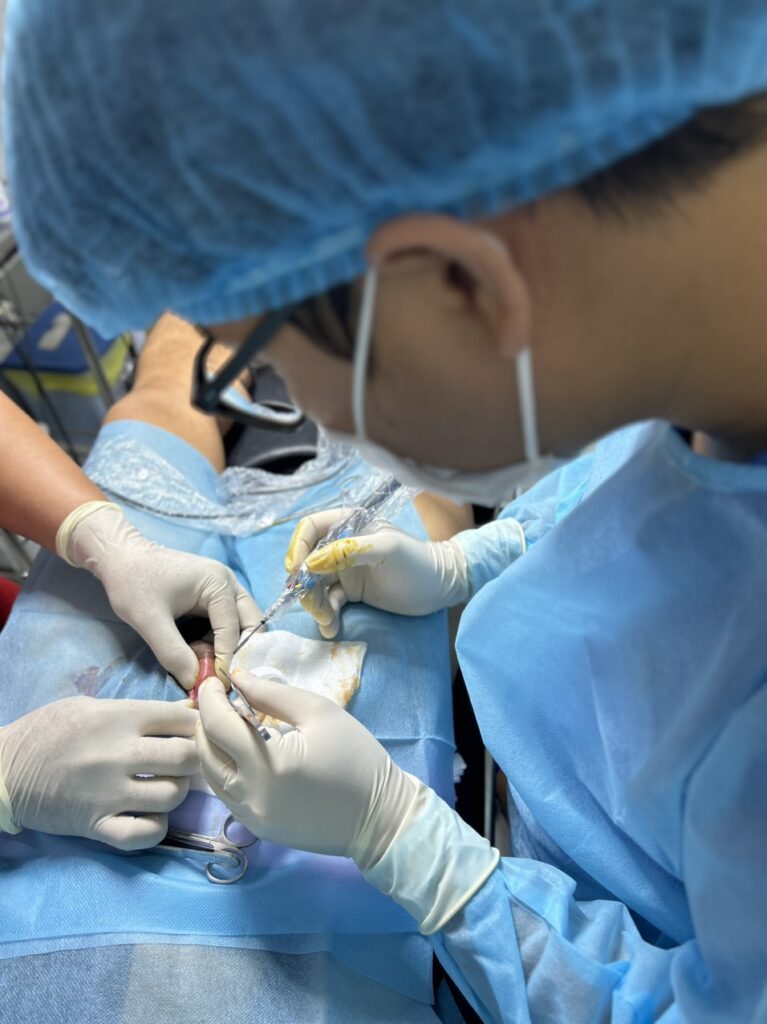 đốt điện chữa sùi mào gà