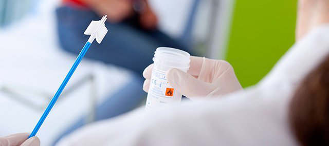 xét nghiệm bệnh sùi mào gà