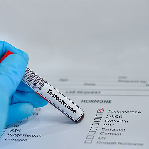 Xét nghiệm testosterone Quy Nhơn Gia Lai