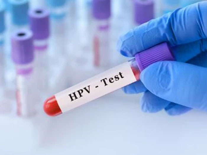 Xét nghiệm HPV